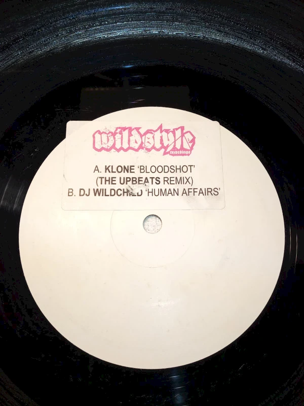 Bloodshot (The Upbeats Remix) / Human Affairs VIP